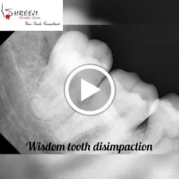 Shreeji Dental Care & Implant Center|Root Canal Treatment|Clear Aligners