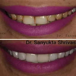 Shrivastava Dental Clinic