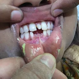 Shubh Dental Clinic Khargone
