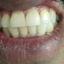Shubli Dental