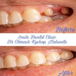 Smile Dental Clinic, Dr Obinash Kyshap Mahanta(Dental Surgeon)