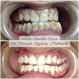 Smile Dental Clinic, Dr Obinash Kyshap Mahanta(Dental Surgeon)