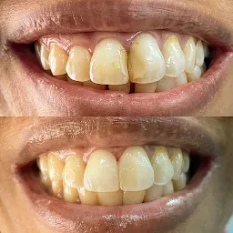 Smile Studio- Cosmetic Dentist In Worli