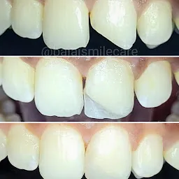 Dr Pankaj Bajaj's Smilecare Dental Clinic & Implant Centre