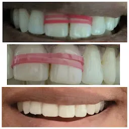 Smilestone dental care