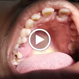 Snegaa's dental care