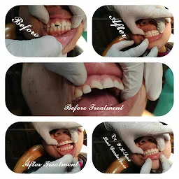 Soni Dental Implant & Orthodontic Centre