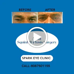Spark Eye Clinic#Dr. Harshada Khandrani#Cataract surgeon #squint surgeon #Pediatric Opthalmologist #Lasik surgeon