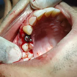 Suneil Dentals - Real Dentistry-Honest info Dohra Road