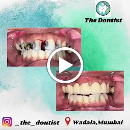 The Dontist