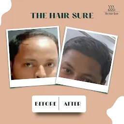 The Hair Sure