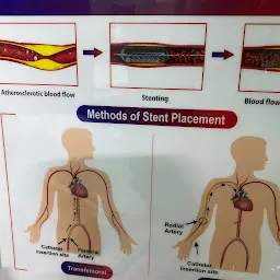 The Heart Care Center - Dr. Ashish Chauhan