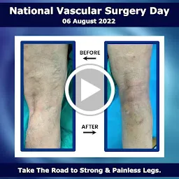 The Vascular Center- Vascular Surgeon in Mumbai | Varicose Veins Specialist Doctor in Mumbai | DVT Treatment