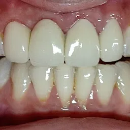 Tru Smile Multi Specialty Dental Clinic