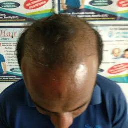 True Hair Transplant