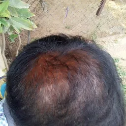 Vcare Ronak Patel hair extensions