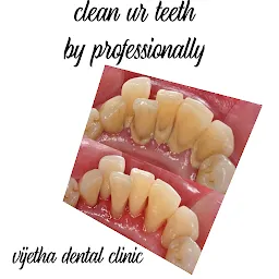 Vijetha dental clinic